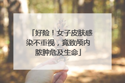 好险！女子皮肤感染不重视，竟致颅内脓肿危及生命